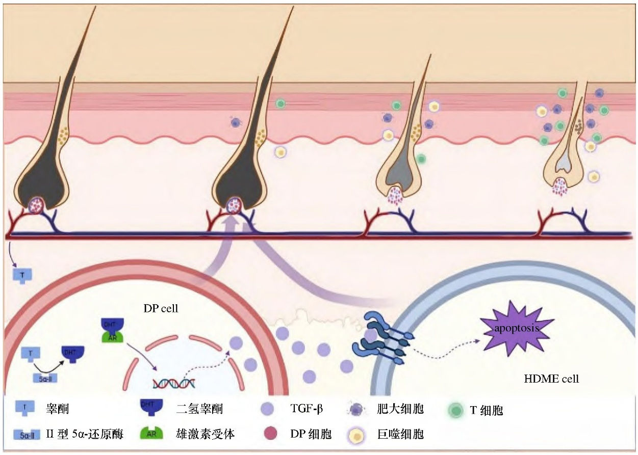 90%脱发都是因为它!雄激素性脱发研究进展与AGA动物模型介绍
