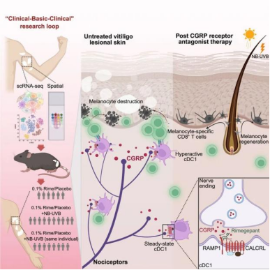顶刊破局：《Immunity》解码白癜风神经免疫致病密码，为药物开发锚定新方向