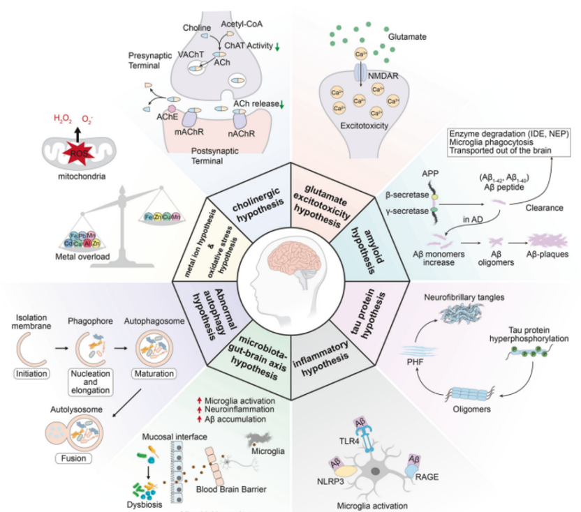 阿尔茨海默病的发现和新药进展