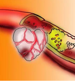 巨噬细胞ADAM8:心肌梗死后修复的关键抑制靶点
