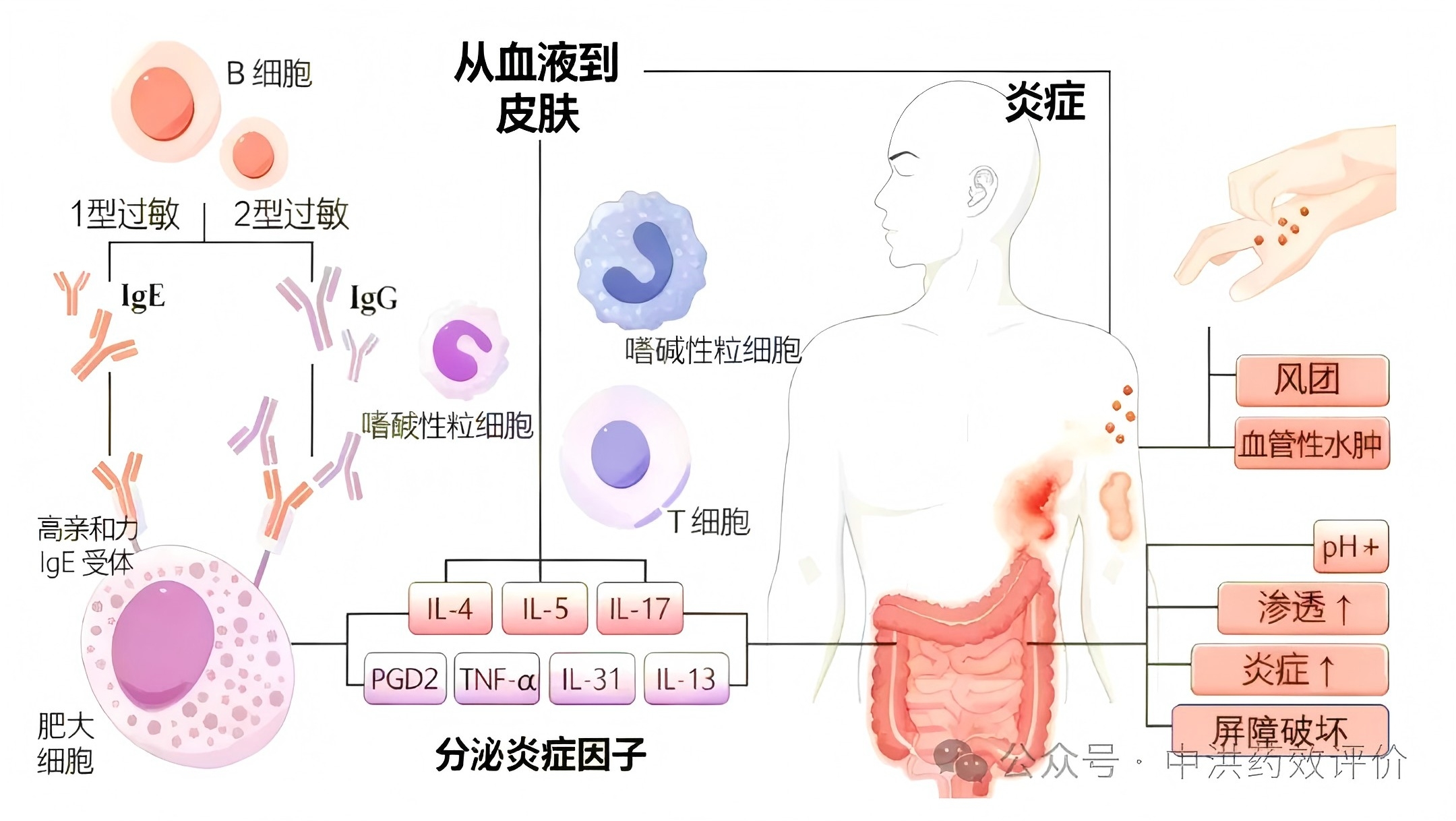 慢性荨麻疹&ldquo;根治&rdquo;时代将启? 口服BTK抑制剂或成最终答案