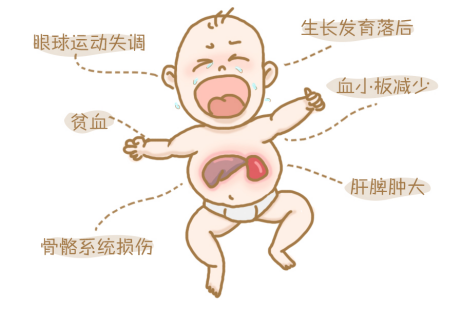 突破治疗瓶颈！戈谢病创新疗法研发迎来新征程