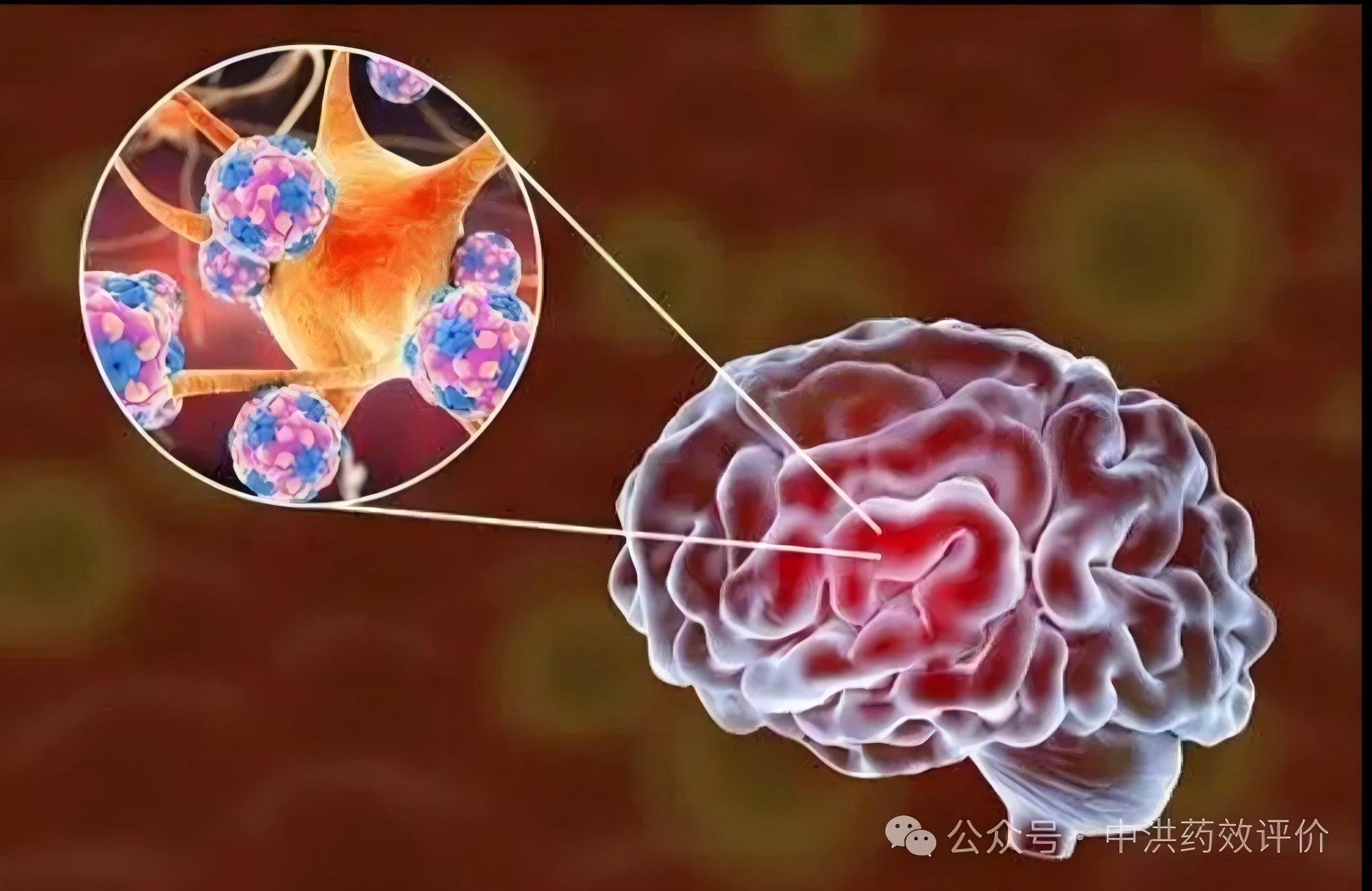 重塑免疫稳态：神经免疫性疾病迎来精准治疗新纪元